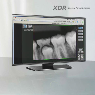 XDR X-ray on monitor image
